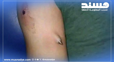 هل هذه الصورة توثق إصابة خلال احتفالات مأرب بوقف إطلاق النار في غزة؟"