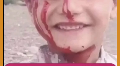 الصورة لطفل من باكستان وليس من البيضاء