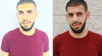 الاعتداء على الصحفي أنس حواري حقيقة ام فوتوشوب