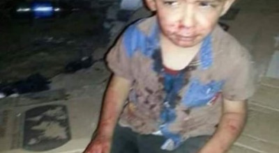 هذه الحادثة قديمة ولا علاقة لها بفلسطين