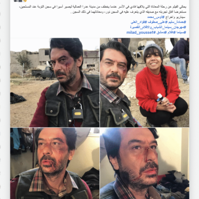 هل تعرض الفنان ميلاد يوسف للضرب في سوريا؟