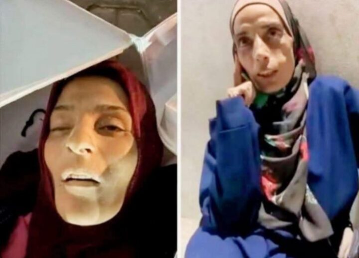 الصورة المتداولة ليست للمواطنة المجوّعة سلوى دحلان.. وإنما لشهيدة من طالبي المساعدات مجهولة الهوية