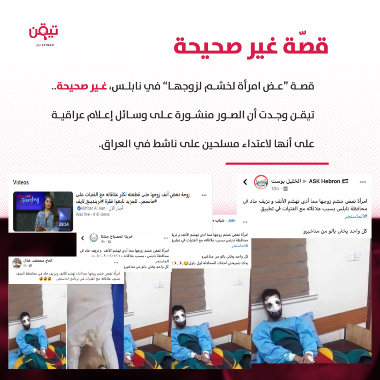 تيقن تكشف حقيقة قصة "امرأة تعض خشم زوجها"!